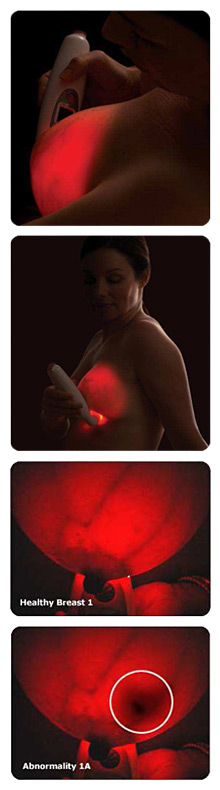 Breastlight views