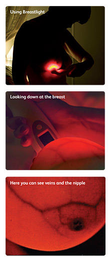 BreastLight in Use