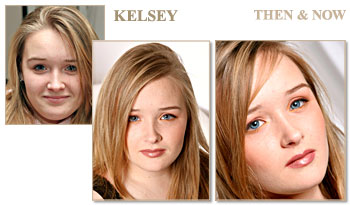 Kelsey - Before and After